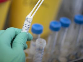 coronavirus test afp scaled