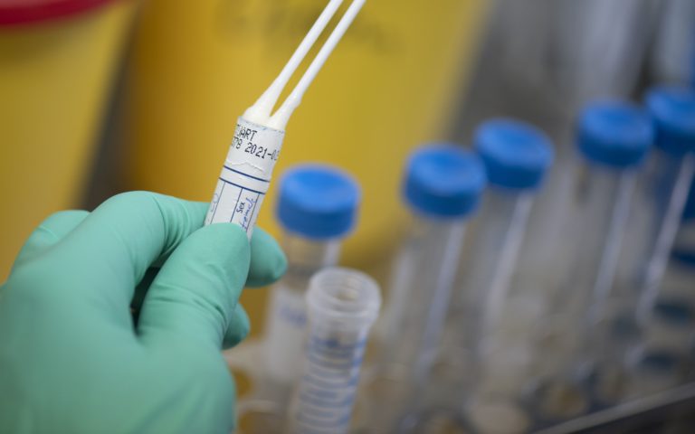 coronavirus test afp scaled