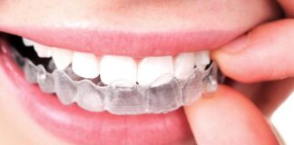 invisalign apparecchio invisibile centro odontoiatrico pitino modica ragusa